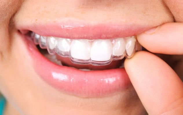 Retainer cleaning to prevent retainers smell bad and reduce bacteria build-up