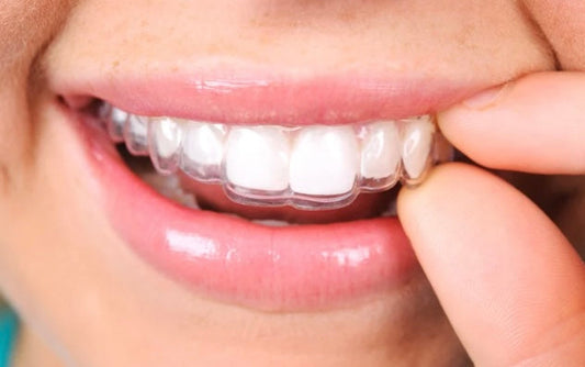 Retainer cleaning to prevent retainers smell bad and reduce bacteria build-up