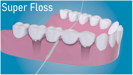 Oral-B Superfloss dental floss threader cleaning teeth with braces and implants model